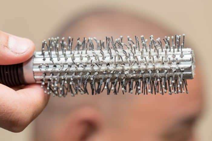 dandruff on the comb bald head
